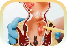Icon for Anal Aesthetics