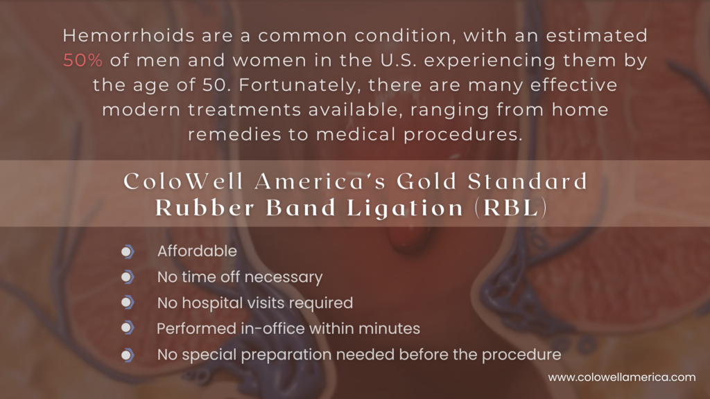 500 PCS German Silicone Hemorrhoid Bands – Rubber Band Ligation, UK FDA, SD0653