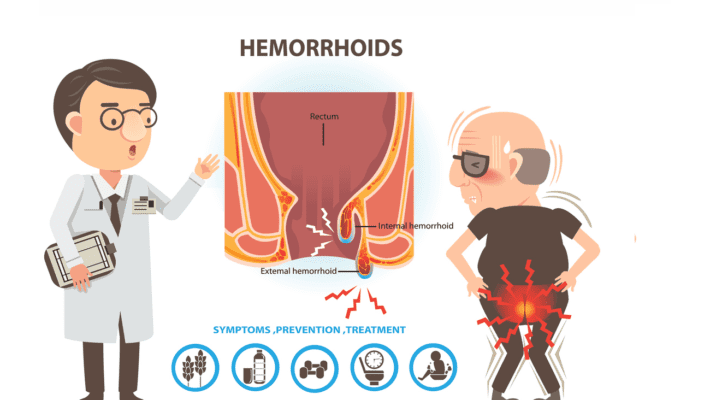 colorectal doctor and hemorrhoid patient illustration