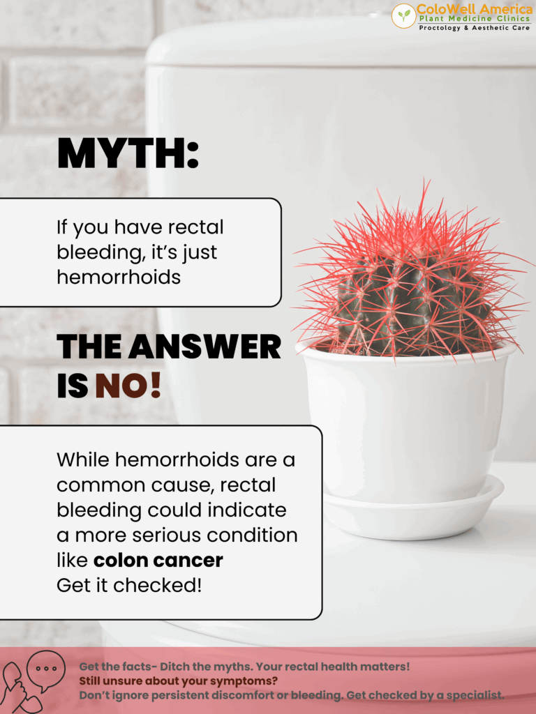Hemorrhoid myth Vs facts