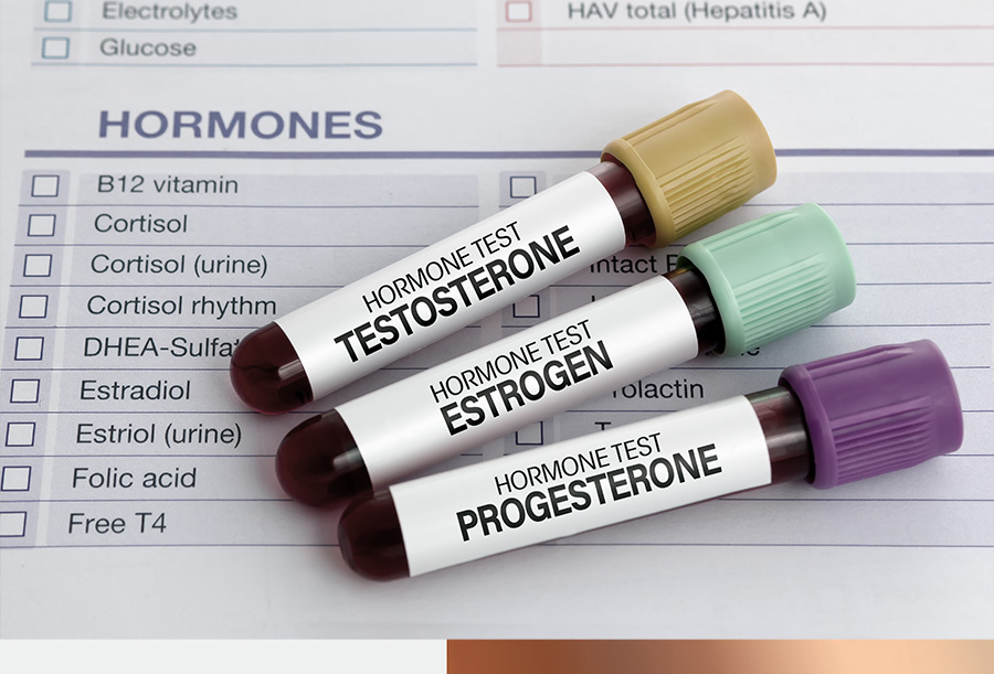 Hormone Replacement Therapy HRT